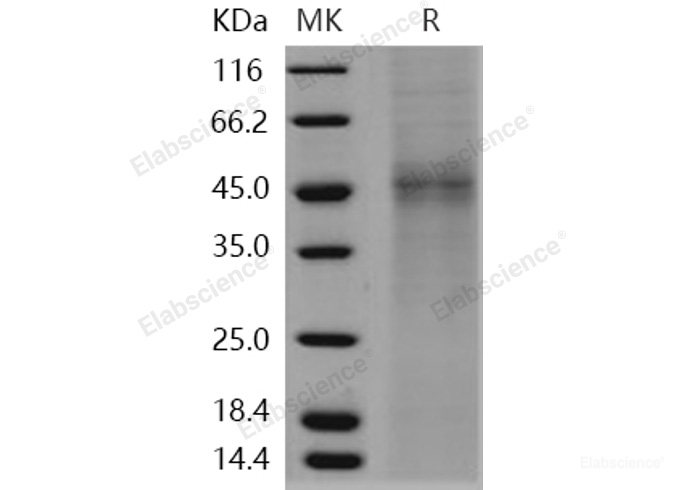 Recombinant Human TPST1 Protein (His tag)-Elabscience