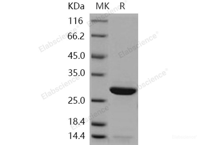 Recombinant Human Peroxiredoxin 6 / PRDX6 Protein (His tag)-Elabscience