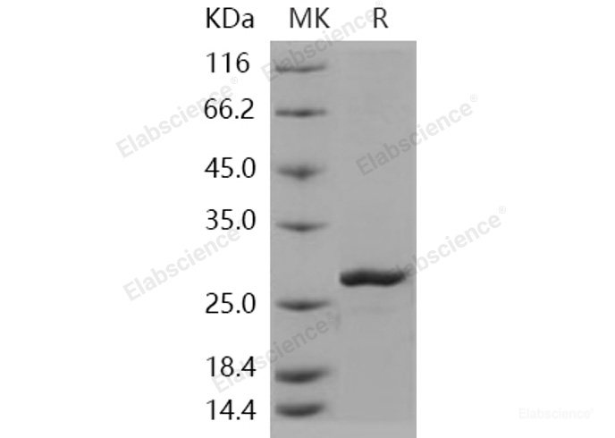 Recombinant Human Peroxiredoxin 2 / PRDX2 Protein (His tag)-Elabscience