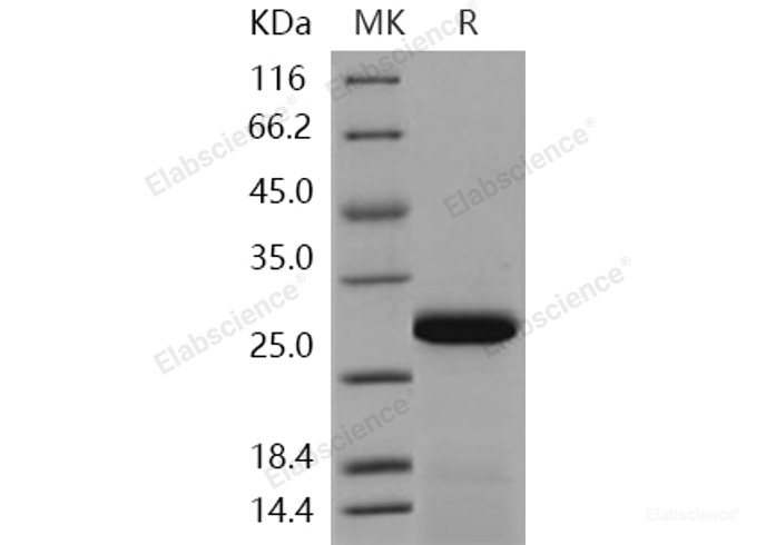 Recombinant Human PPM1G / PP2C-gamma Protein (aa 317-546, His tag)-Elabscience