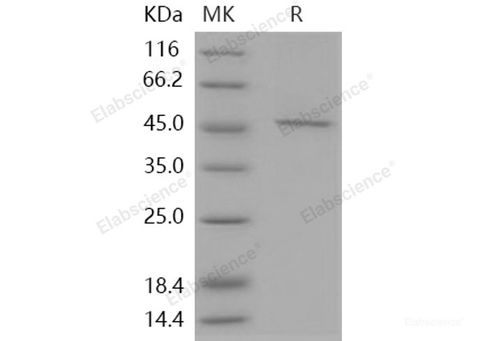 Recombinant Human SMYD3 / ZMYND1 Protein (His & FLAG tag)-Elabscience