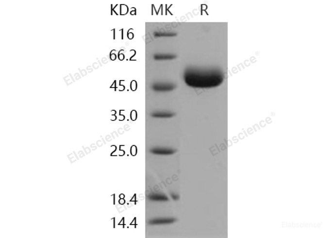 Recombinant Human Carboxypeptidase M / CPM Protein (His tag)-Elabscience