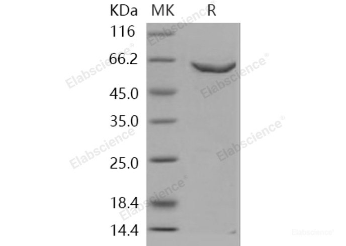 Recombinant Human DNMT2 / TRDMT1 Protein (GST tag)-Elabscience