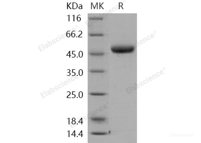 Recombinant Human Chitotriosidase / Chitinase 1 / CHIT1 Protein (His tag)-Elabscience