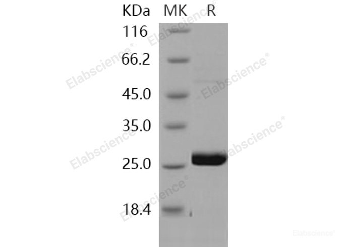 Recombinant Human METTL11A Protein-Elabscience