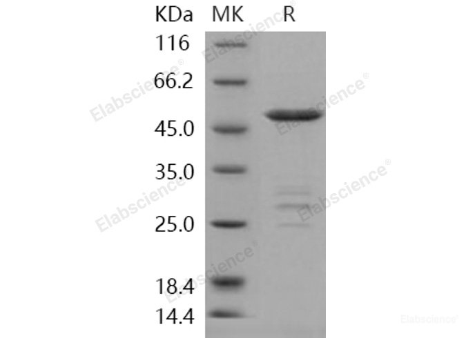 Recombinant Human METTL11A Protein (GST tag)-Elabscience