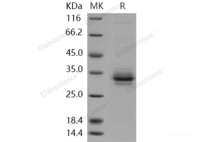 Recombinant Human FOLR2 / FBP Protein (His tag)-Elabscience