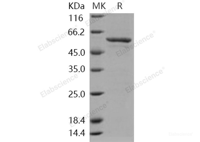 Recombinant Human SMYD3 / ZMYND1 Protein (GST tag)-Elabscience