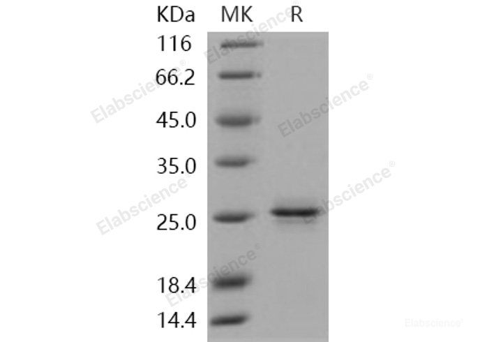 Recombinant Human PRDM2 / RIZ1 Protein-Elabscience