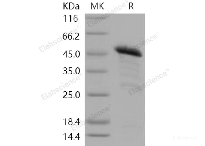 Recombinant Human PRDM2 / RIZ1 Protein (GST tag)-Elabscience