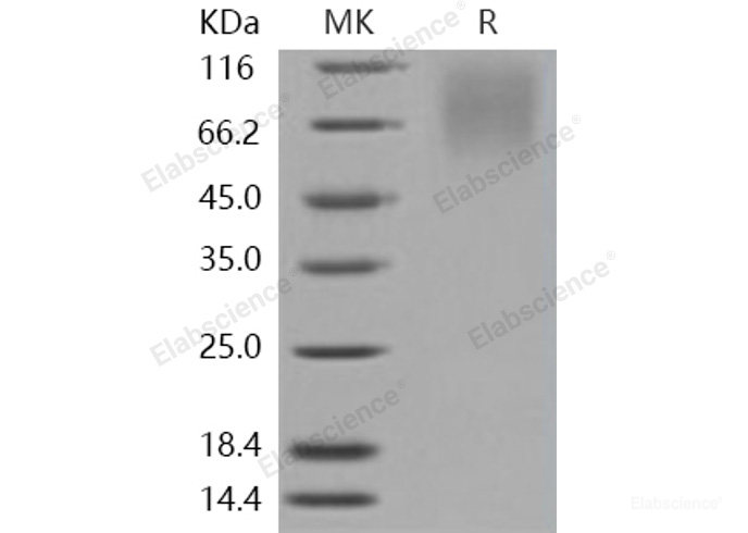 Recombinant Human LAMP1 / CD107a Protein (His tag)-Elabscience