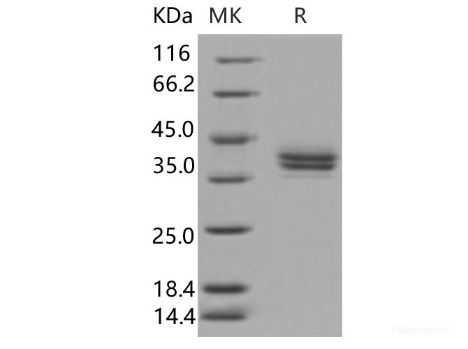 Recombinant Human CADM3 Protein (His Tag)-Elabscience