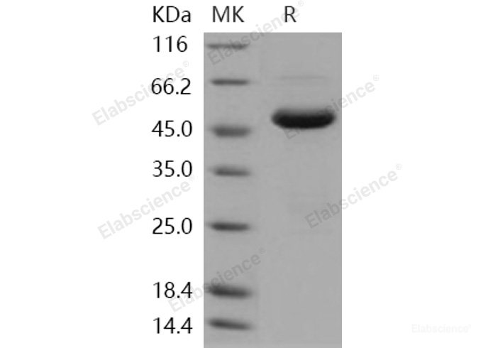 Recombinant Human SETD7 / SET7/9 Protein (His tag)-Elabscience