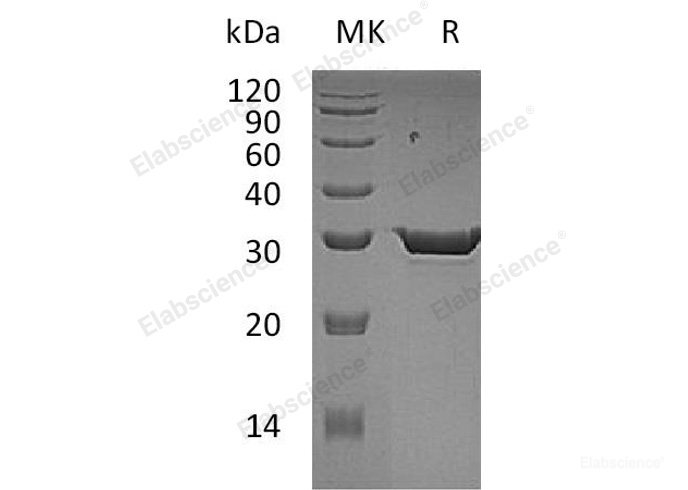 Recombinant Human 15-PGDH Protein (His Tag)-Elabscience