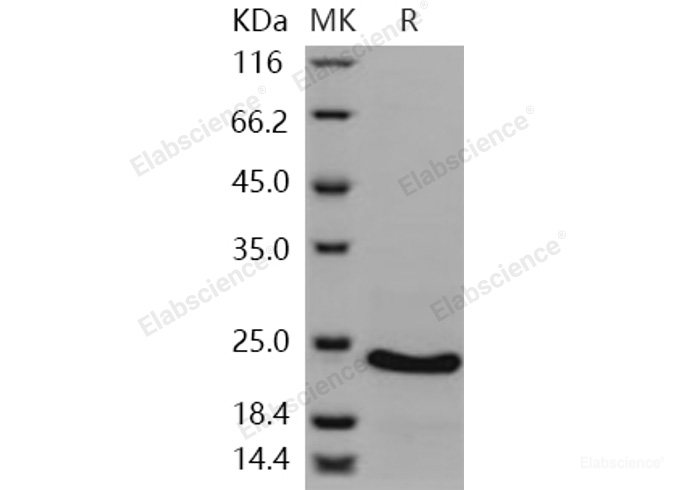Recombinant Human CSRP1 Protein (His tag)-Elabscience