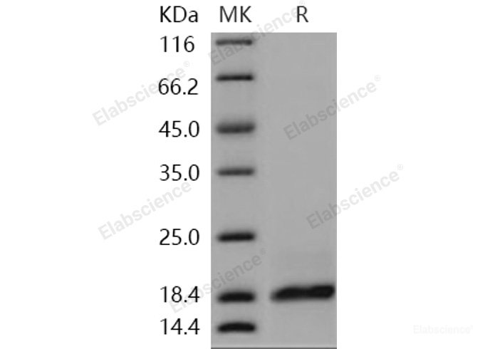 Recombinant Human PLA2G2A / PLA2B Protein (His tag)-Elabscience