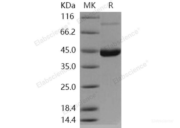 Recombinant Human ENTPD5 Protein (His tag)-Elabscience