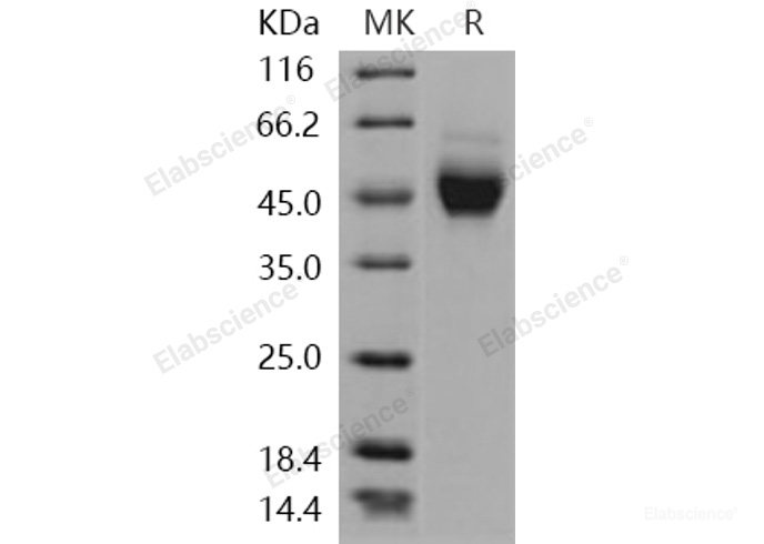 Recombinant Human NEGR1 Protein (His tag)-Elabscience
