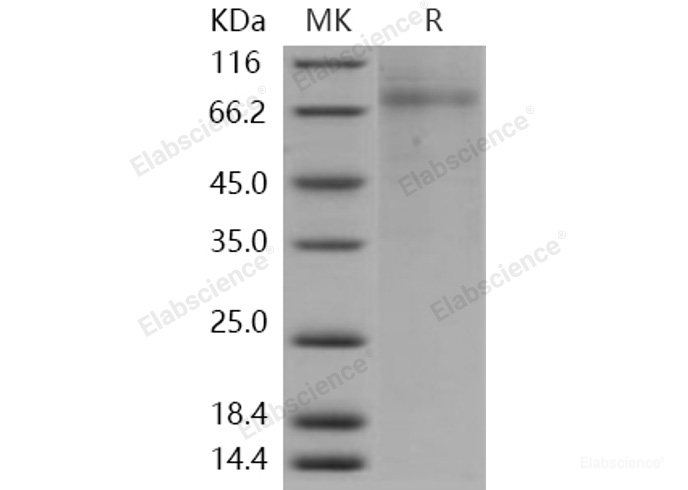 Recombinant Human PLTP Protein (His tag)-Elabscience