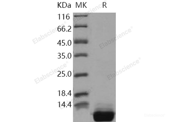 Recombinant Human S100A10 Protein (His tag)-Elabscience