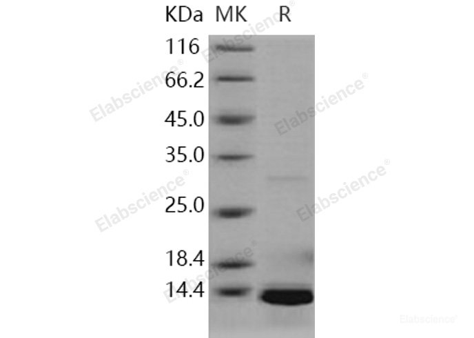 Recombinant Human S100A5 Protein (His tag)-Elabscience