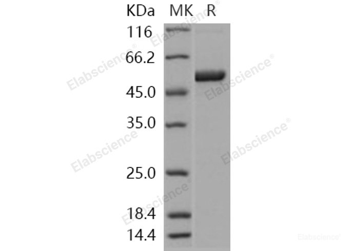 Recombinant Human S100A3 / S100E Protein (His & MBP tag)-Elabscience