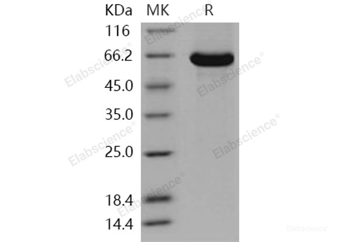Recombinant Human AACS / Acetoacetyl-CoA Synthetase Protein (His tag)-Elabscience