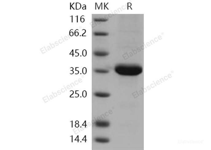Recombinant Human ACBD6 Protein (His tag)-Elabscience