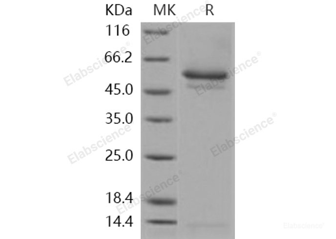 Recombinant Human SerpinI1 / Neuroserpin Protein (His tag)-Elabscience