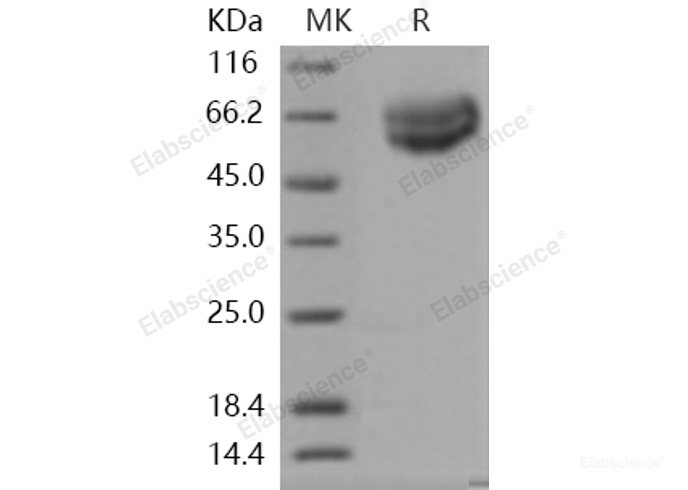 Recombinant Human IL18R1 / CD218a Protein (His tag)-Elabscience