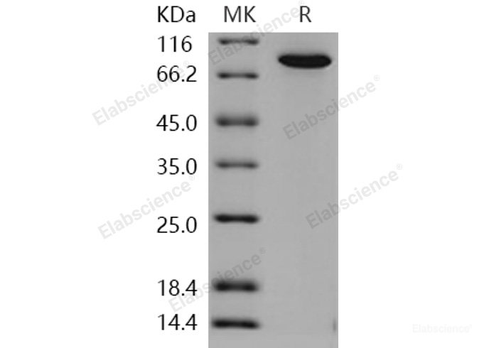 Recombinant Human TGM2 / Transglutaminase 2 Protein (His tag)-Elabscience