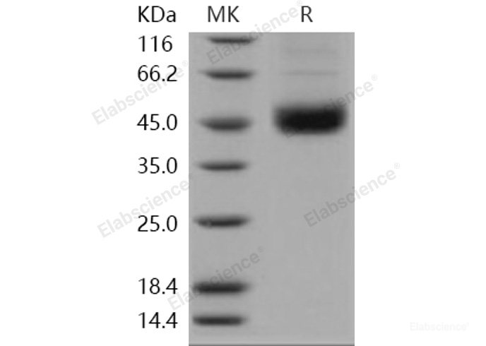 Recombinant Human SMYD2 / KMT3C Protein (His tag)-Elabscience