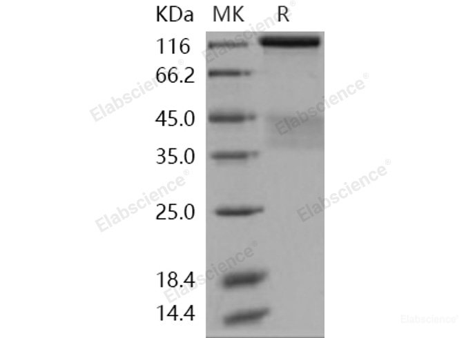 Recombinant Human Insulin Receptor / INSR / CD220 Protein (short isoform, His tag)-Elabscience