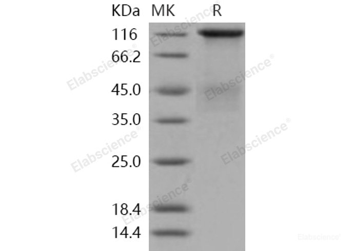 Recombinant Human Insulin Receptor / INSR / CD220 Protein (long isoform, His tag)-Elabscience