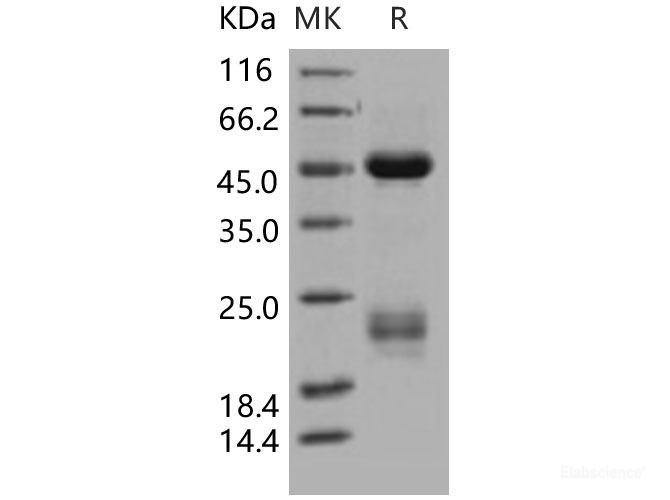 Recombinant Human Coagulation Factor X / FX / F10 Protein (His tag)-Elabscience