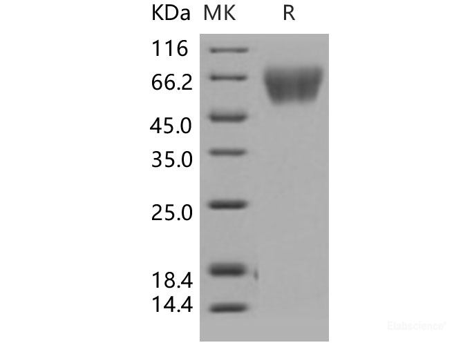 Recombinant Human TrkA / NTRK1 Protein (His tag)-Elabscience