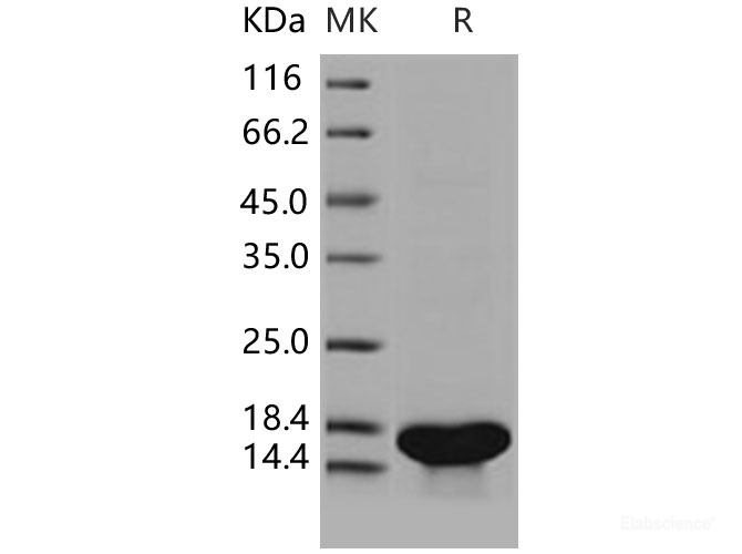 Recombinant Human TrkA / NTRK1 Protein (aa 285-413, His tag)-Elabscience