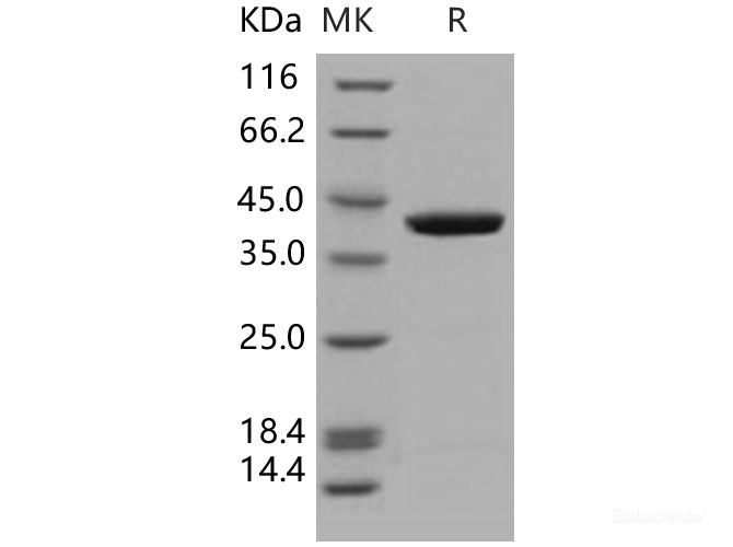 Recombinant Human GFPT1 / GFAT Protein-Elabscience