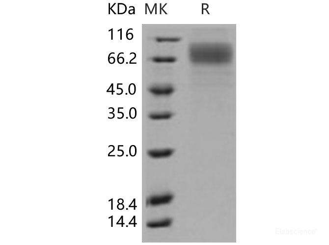 Recombinant Human SCARB1 / CD36L1 / CLA-1 Protein (His tag)-Elabscience