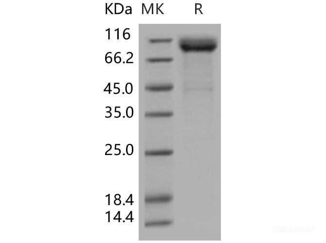 Recombinant Human LIMP-2 / SCARB2 / CD36L2 Protein (His & Fc tag)-Elabscience