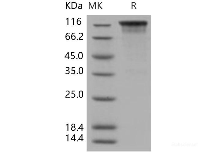 Recombinant Human KIM-1 / TIM1 / HAVCR1 Protein (His & Fc tag)-Elabscience