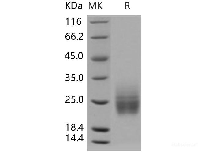 Recombinant Human KIM-1 / TIM1 / HAVCR1 Protein (aa 1-135, His tag)-Elabscience