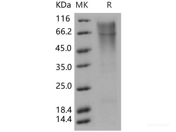 Recombinant Human KIM-1 / TIM1 / HACVR1 Protein (His tag)-Elabscience