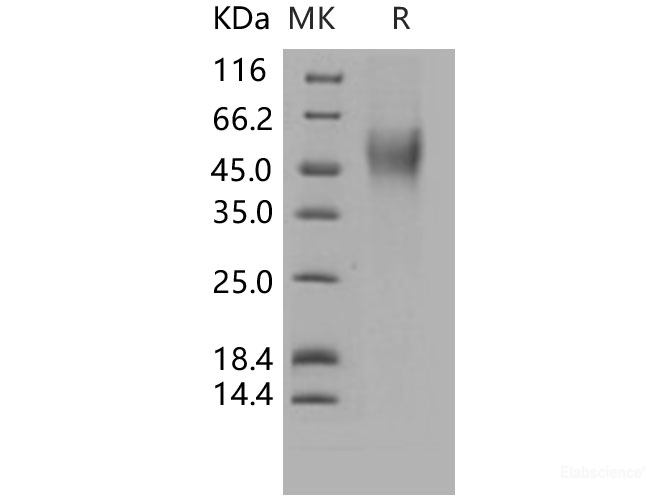 Recombinant Human CD16b / FCGR3B Protein (His tag)-Elabscience