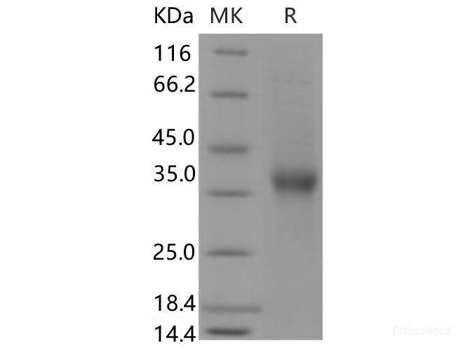 Recombinant Human CD8 beta Protein (Fc Tag)-Elabscience