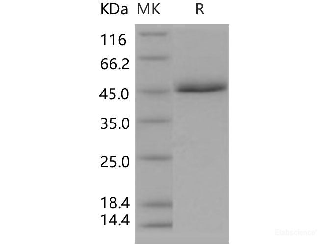 Recombinant Human CD5 Protein (His tag)-Elabscience