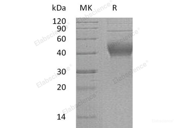 Recombinant Human IL-22BP Protein (His Tag)-Elabscience