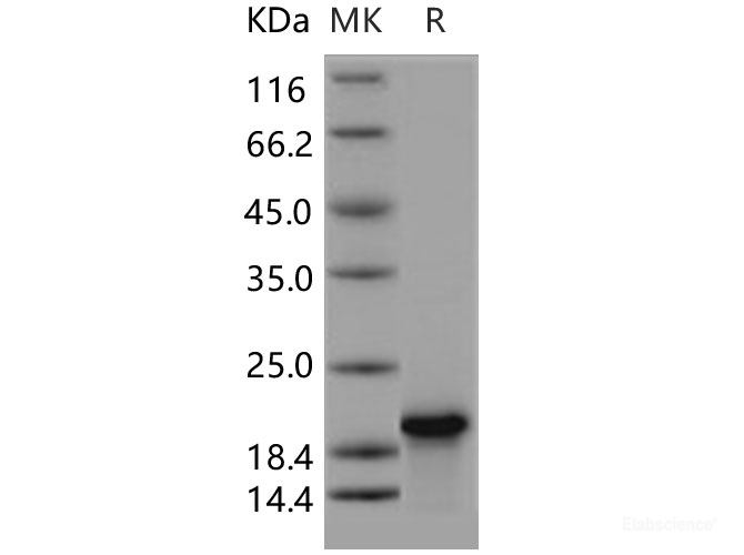 Recombinant Human Troponin C / TNNC1 Protein-Elabscience