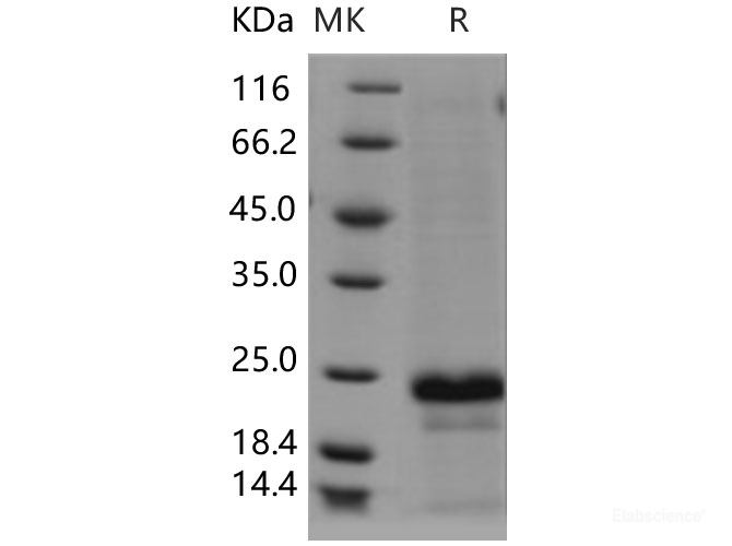Recombinant Human CD20 / MS4A1 Protein (aa 213-297, His tag)-Elabscience