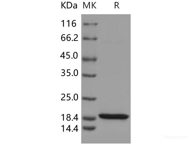 Recombinant Human KIAA0101 / p15 / PAF Protein (His tag)-Elabscience